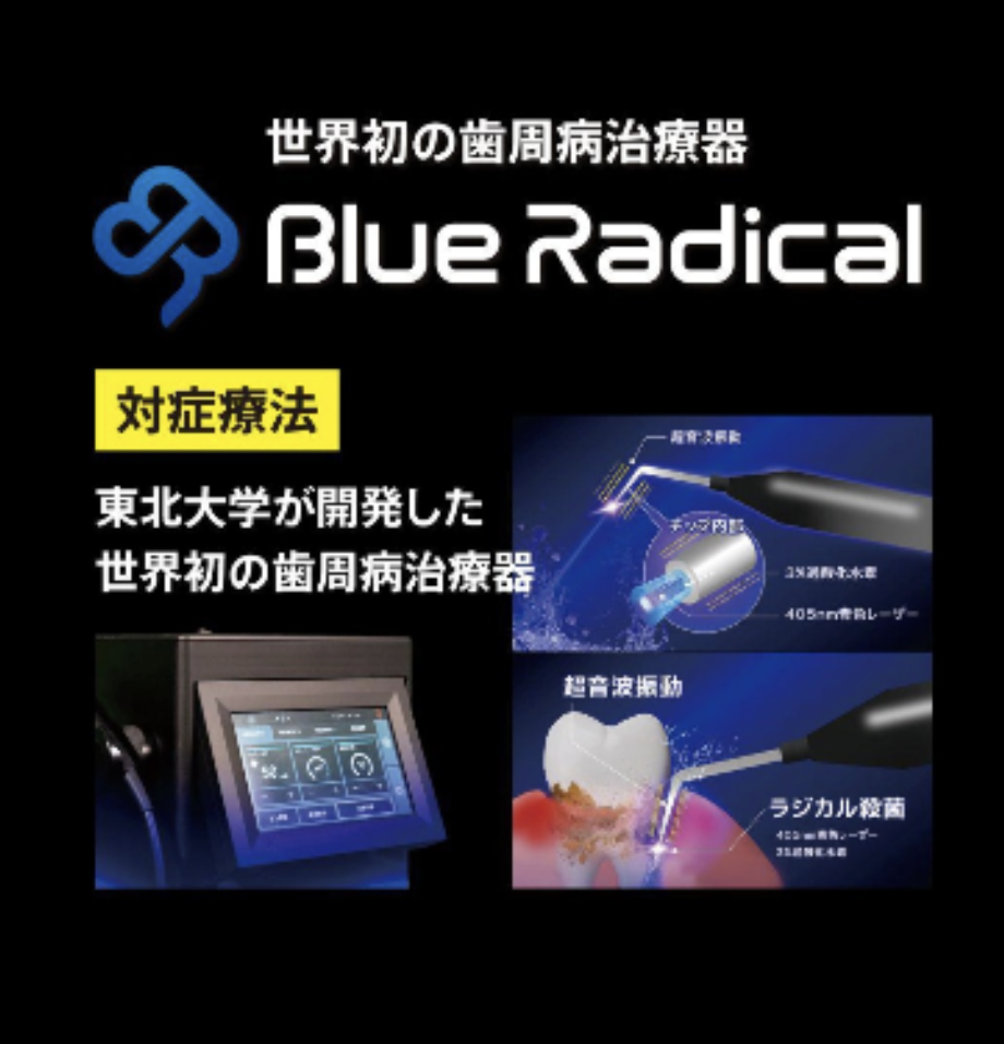 ブルーラジカル - 世界初の歯周病治療器